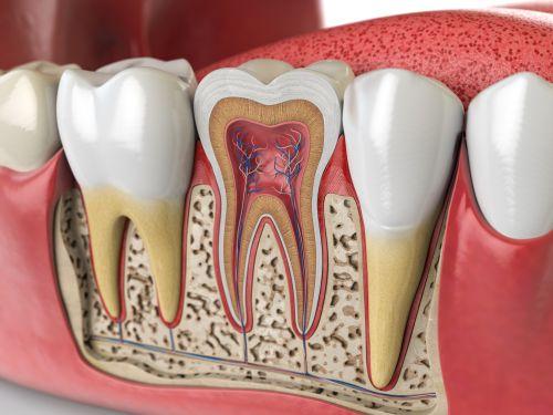 A graphic image depicting teeth roots in Wahroonga, NWS