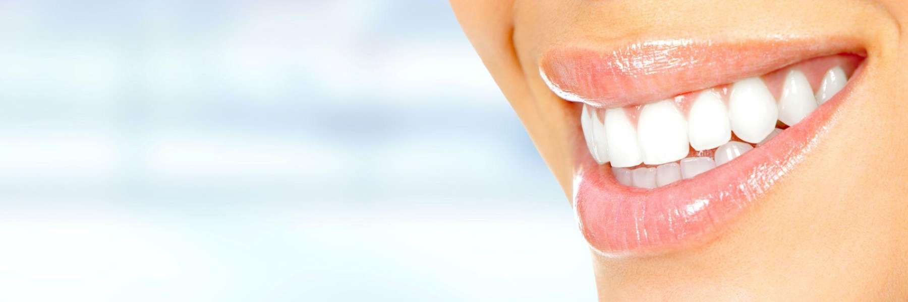 An image showing white teeth in Wahroonga, NWS