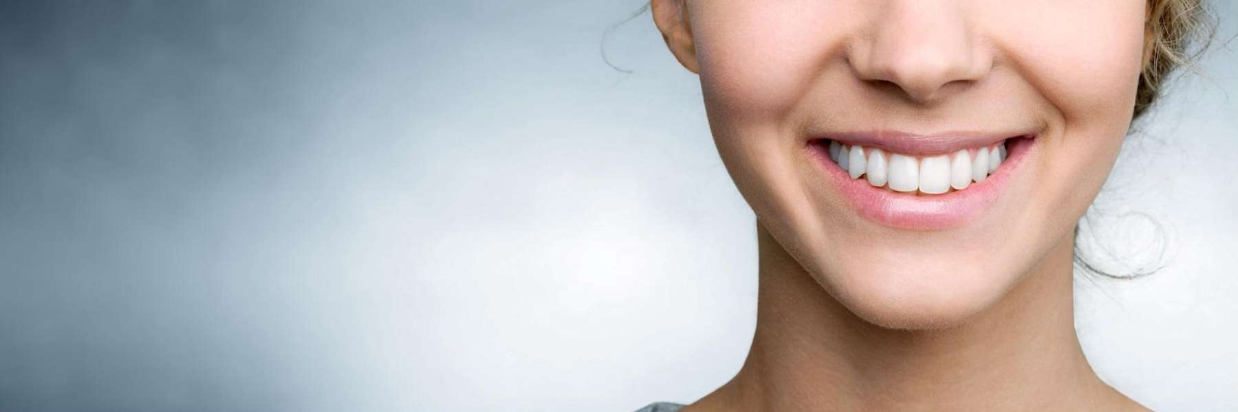 An image of a woman smiling after getting a Teeth Whitening services in Wahroonga, NWS