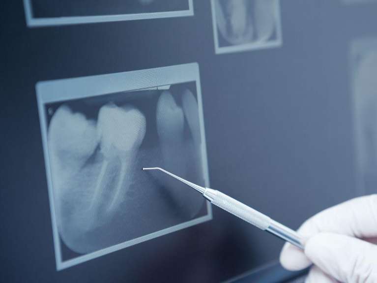 An image of teeth under Digital X-Rays and Sensors in Wahroonga